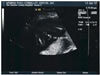April 12, 2007 Sonogram